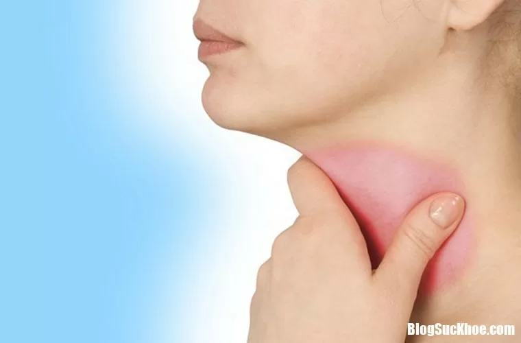 Những dấu hiệu của bệnh ung thư thanh quản