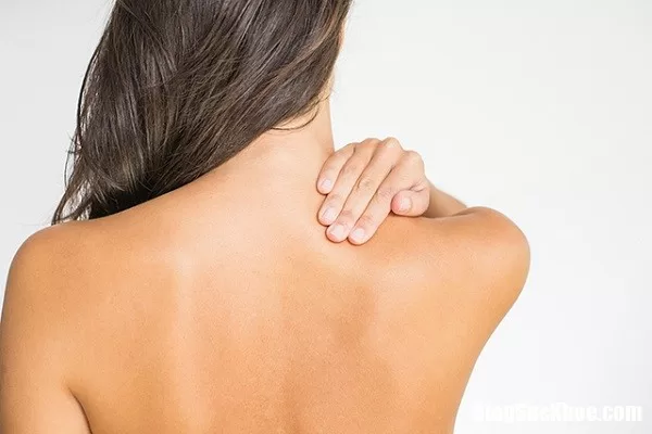 Những cách trị thâm mụn ở lưng đơn giản mà hiệu quả