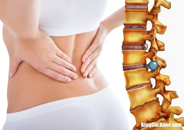 Những cơn đau lưng cảnh báo bệnh nguy hiểm cần đề phòng sớm