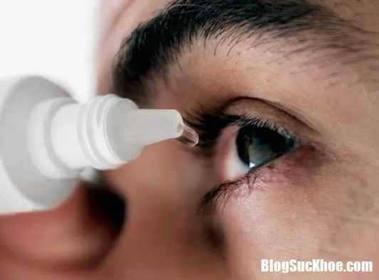 Những điều cần lưu ý khi bị đau mắt đỏ