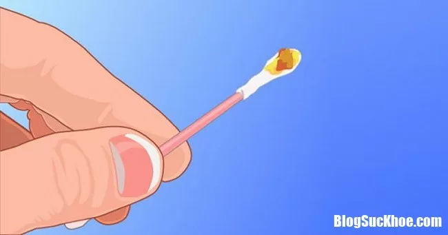 Xem màu sắc ráy tai đoán sức khỏe của bạn
