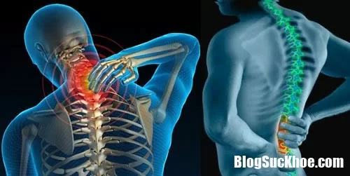 Triệu chứng gai cột sống và các phương pháp phẫu thuật điều trị