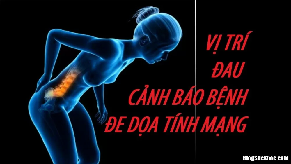Những vị trí đau báo hiệu bệnh nguy hiểm khôn lường