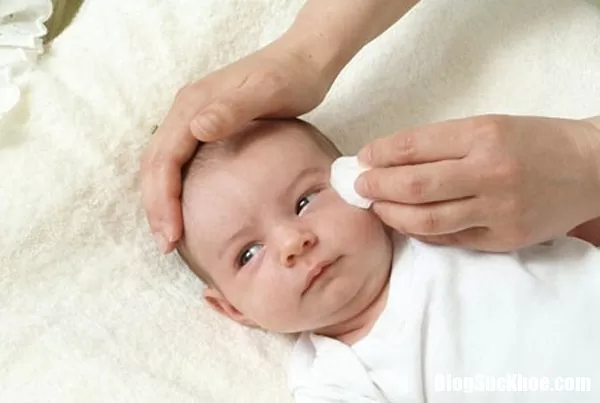 Dấu hiệu và cách chăm sóc trẻ sơ sinh bị mắt đỏ