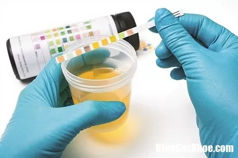 Nước tiểu có bọt cảnh báo cơ thể đang gặp nguy hiểm không thể bỏ qua