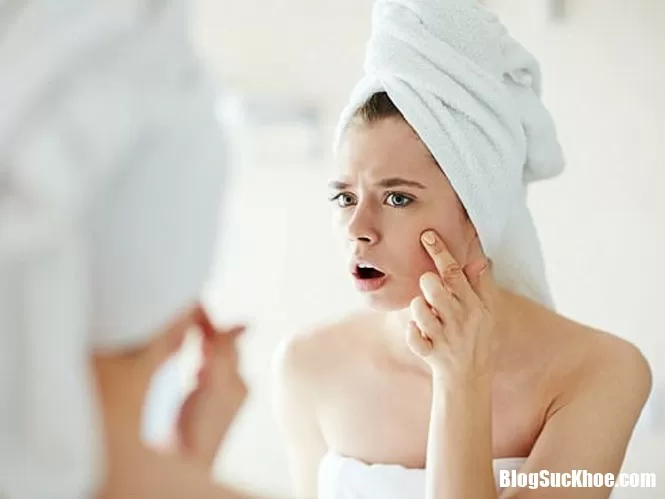 Cách điều trị mụn trứng cá hiệu quả