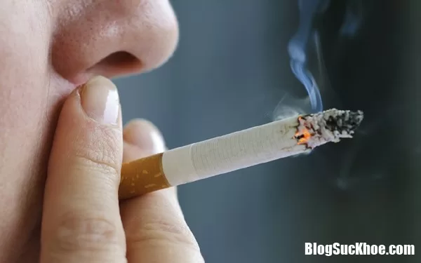 Nguyên nhân và cách phòng ngừa bệnh ung thư phổi