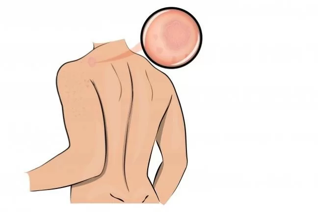 Nhận biết cơ thể đang căng thẳng, mệt mỏi qua những dấu hiệu sau