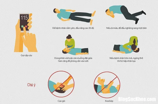 Cách xử lý kịp thời khi người thân bị đột quỵ giúp tránh biến chứng nặng