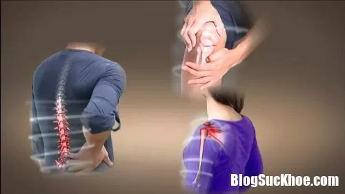 Những triệu chứng đau xương khớp thường xuất hiện ở tuổi trung niên