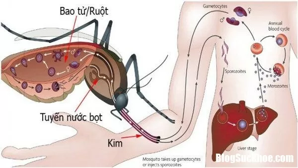 Cách đơn giản nhận biết sốt xuất huyết, sốt phát ban