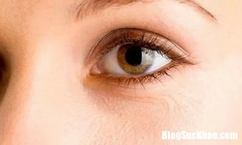 Hiện tượng nháy, co giật mắt ở người nguyên nhân do đâu ?