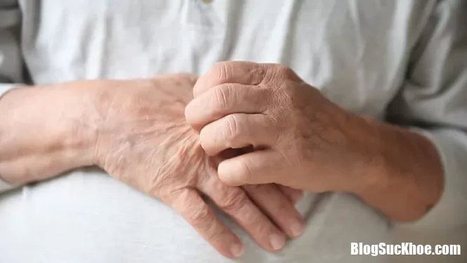 Chữa trị bệnh chàm bằng cách tắm với nước