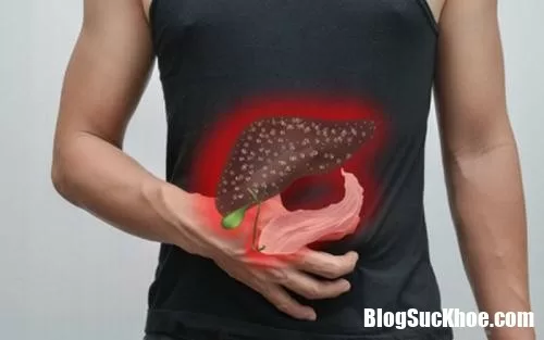 Nhận biết nguyên nhân dẫn đến tình trạng gan nhiễm mỡ