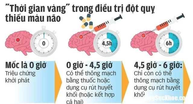 Cứu đột quỵ cần lưu ý đến 'giờ vàng'