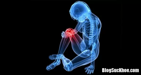 Xương có nguy cơ mục ruỗng do những thói quen xấu hằng ngày này