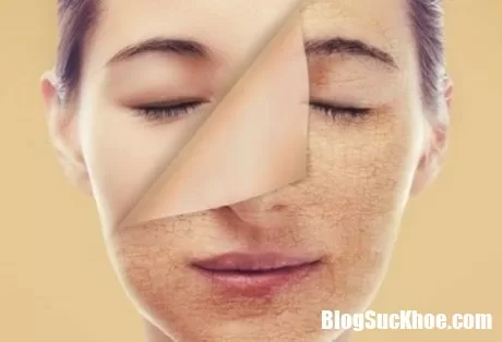 Những dấu hiệu cảnh báo sớm bệnh ung thư chị em chớ nên lơ là