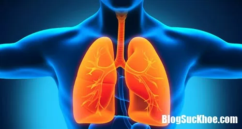 Nguyên nhân và cách điều trị bệnh tràn khí màng phổi