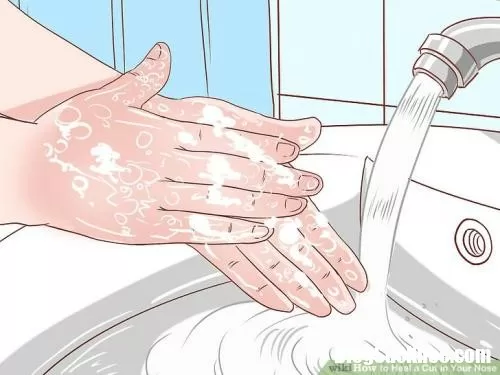 Những cách sơ cứu đơn giản khi bị đứt tay