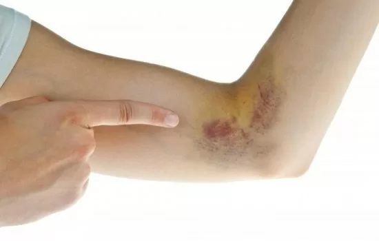 Cách đơn giản chẩn đoán bệnh ung thư máu