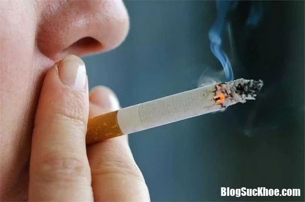 Thói quen thuốc lá hằng ngày gây nên bệnh ung thư phổi