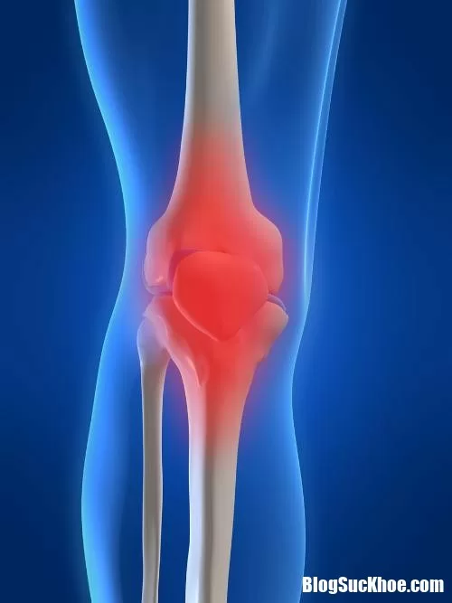 Những triệu chứng nhận biết bệnh loãng xương