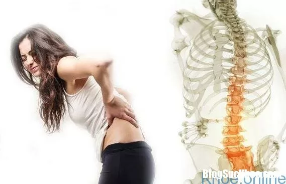 Dấu hiệu nhận biết thoái hóa cột sống thắt lưng