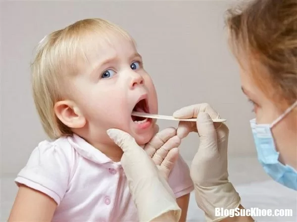 Có nên cắt hay không khi bị viêm amidan mãn tính ?