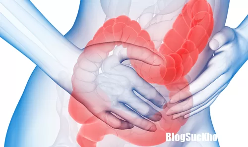 Viêm đại tràng co thắt - Nguyên nhân và cách nhận biết