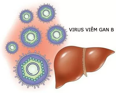 Những kiến thức cần biết về bệnh viêm gan B
