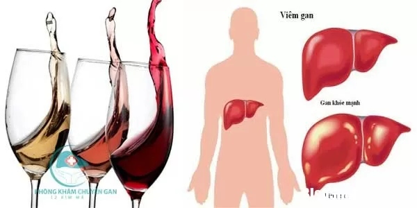 Những báo hiệu suy giảm chức năng gan