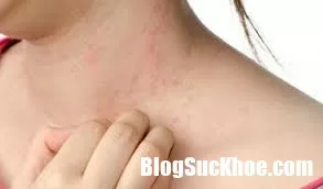 Những nguyên nhân gây bệnh cho da cần biết