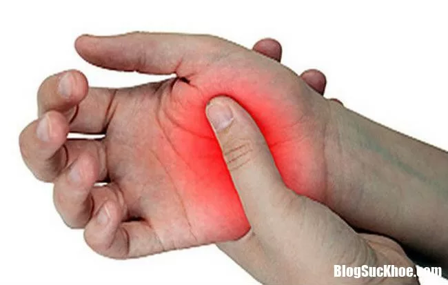 Những vị trí đau trên cơ thể báo hiệu bệnh nguy hiểm