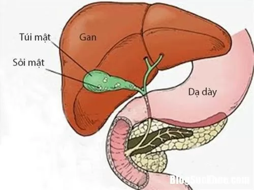 Chớ nên chủ quan với căn bệnh viêm túi mật