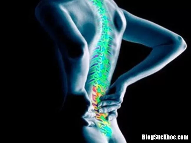 Những triệu chứng của bệnh viêm cột sống dính khớp