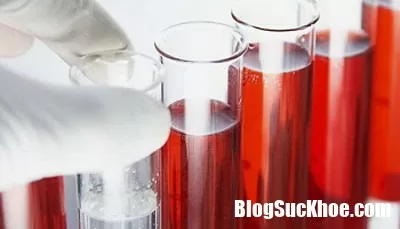 Phát hiện bệnh ung thư phổi nhanh nhất bằng cách xét nghiệm máu