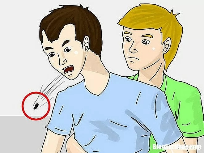 Cách sơ cứu khi bị nghẹn, hóc dị vật