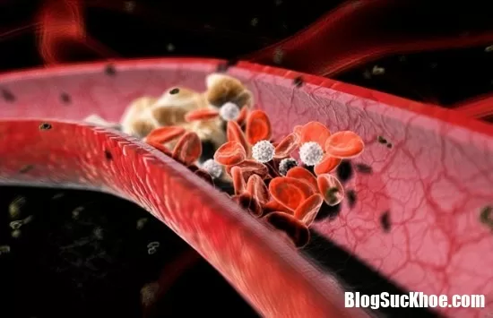 Những bí quyết đơn giản giúp giảm mỡ máu hiệu quả
