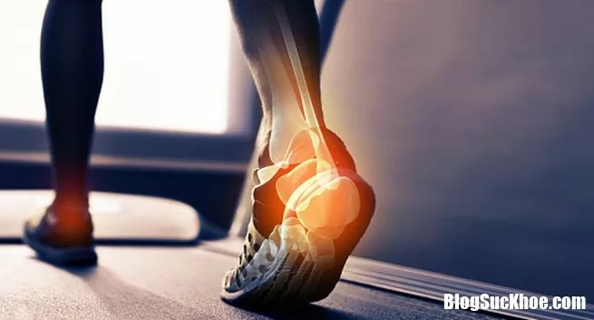 Những dấu hiệu cơ thể bạn không nhận đủ phốt pho