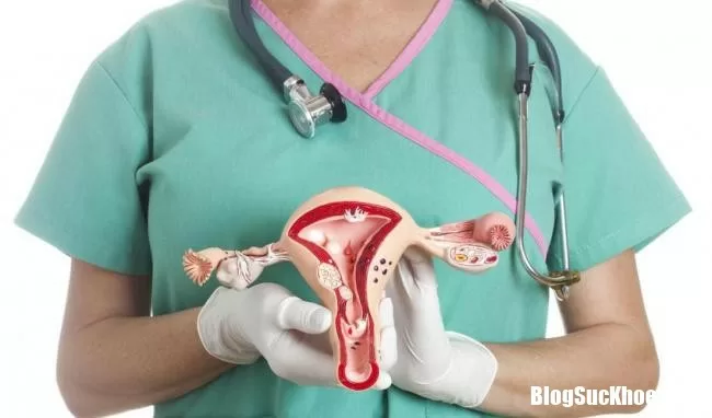 Phụ nữ nên quan tâm nhiều đến bệnh buồng trứng đa nang kẻo bị vô sinh