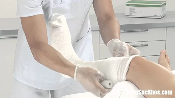 Sau gãy xương nếu không điều trị đúng phương pháp sẽ để lại nhiều di chứng