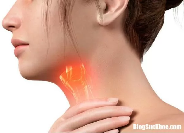Những triệu chứng của bệnh viêm thanh quản chớ nên lơ là