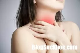 Những cách hạn chế chứng ợ nóng mạn tính