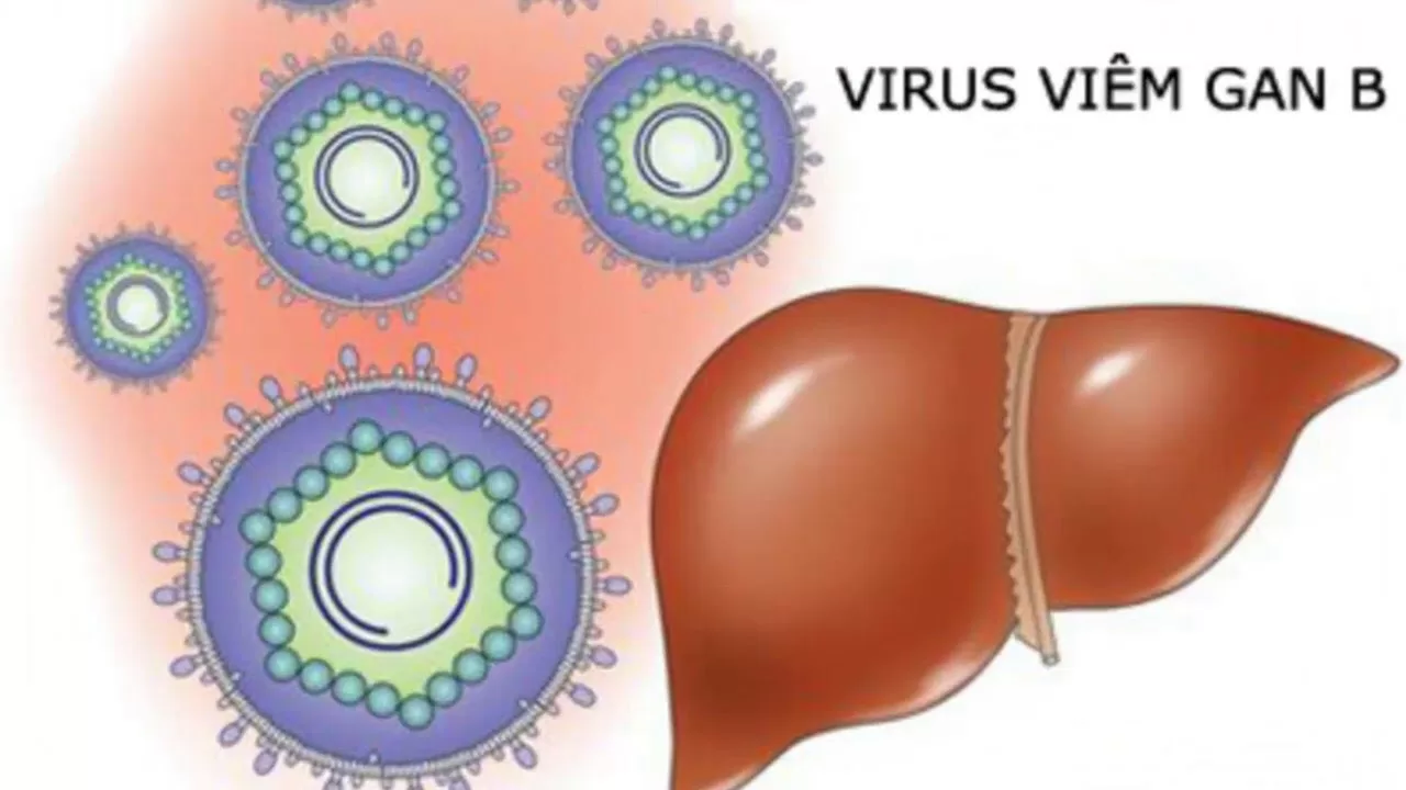 Viêm gan B - căn bệnh dễ duy truyền nhưng ai cũng thờ ơ