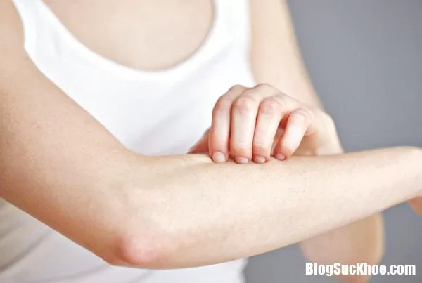 Sử dụng vitamin B1 cần thận trọng kẻo gây ra nguy hiểm
