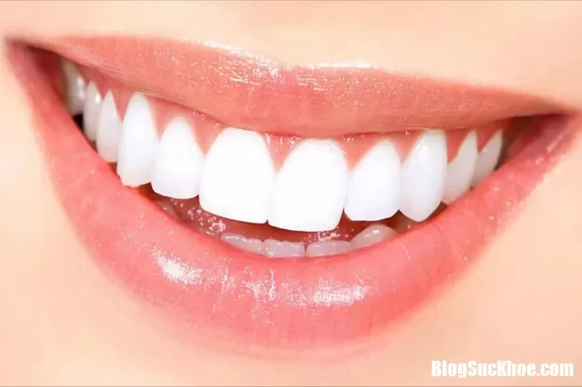 Những cách đơn giản giúp ngăn ngừa bệnh sâu răng
