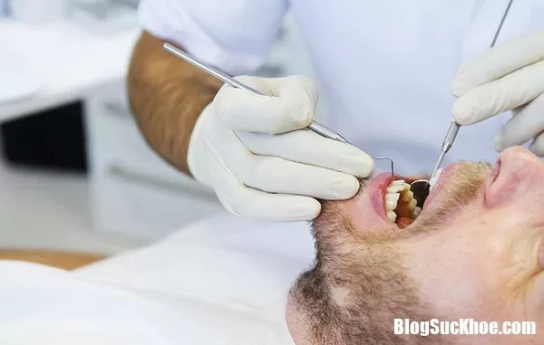 Bệnh nha chu và những mối nguy đối với sức khỏe