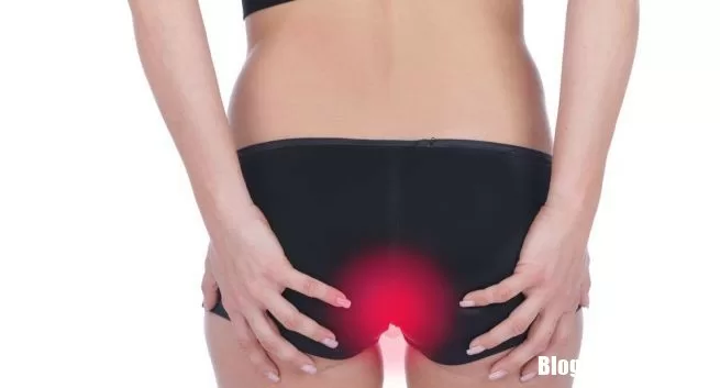 Chế độ ăn uống cần lưu ý đối với người bệnh trĩ