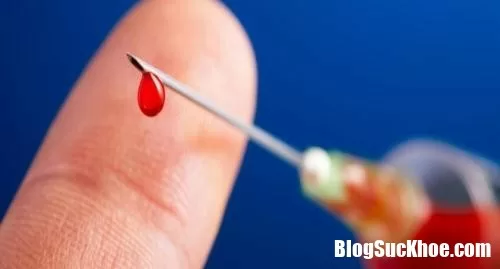 Viêm gan B là gì ? Có chữa khỏi hẳn được không ?