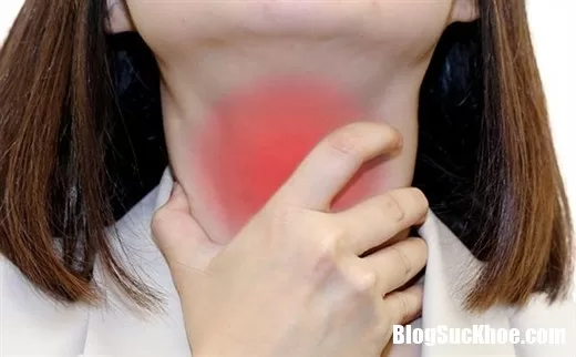 Những cách trị bệnh viêm amidan an toàn và hiệu quả